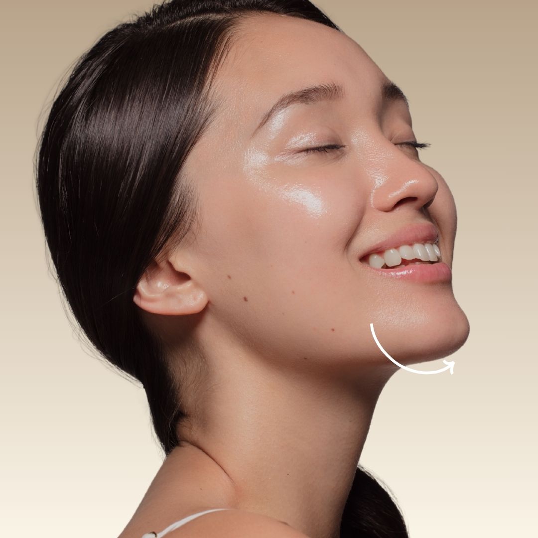 CHIN FILLER